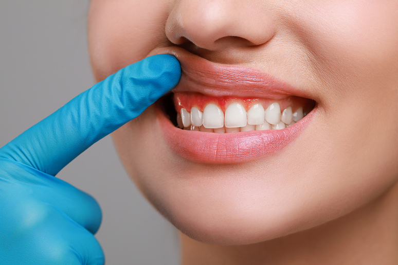 Dentist reviewing findings with a patient